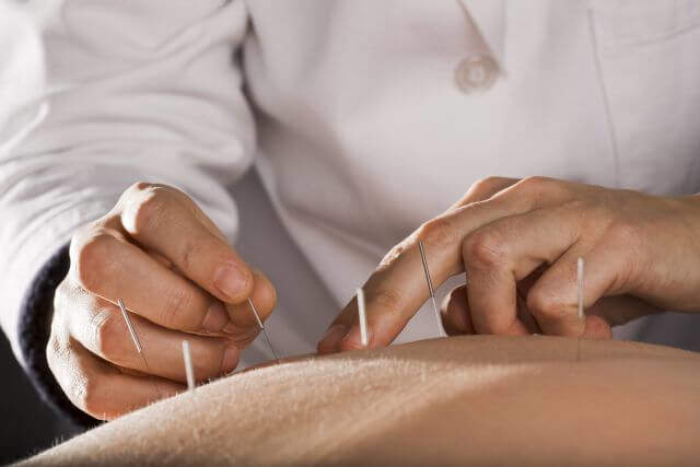 Acupuncture Can Help With Weight Loss