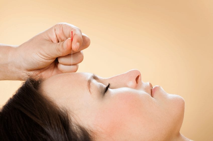 Top Acupuncture Myths