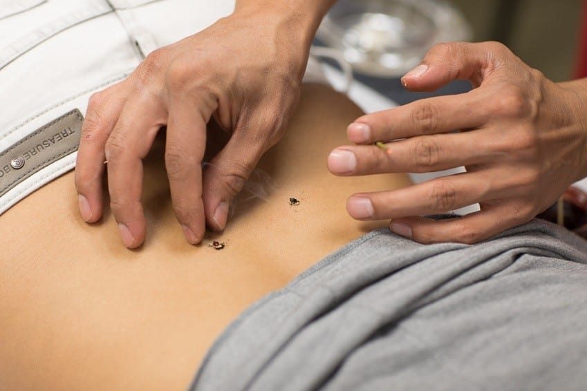 3 Key Ways Acupuncture Supports Men's Health