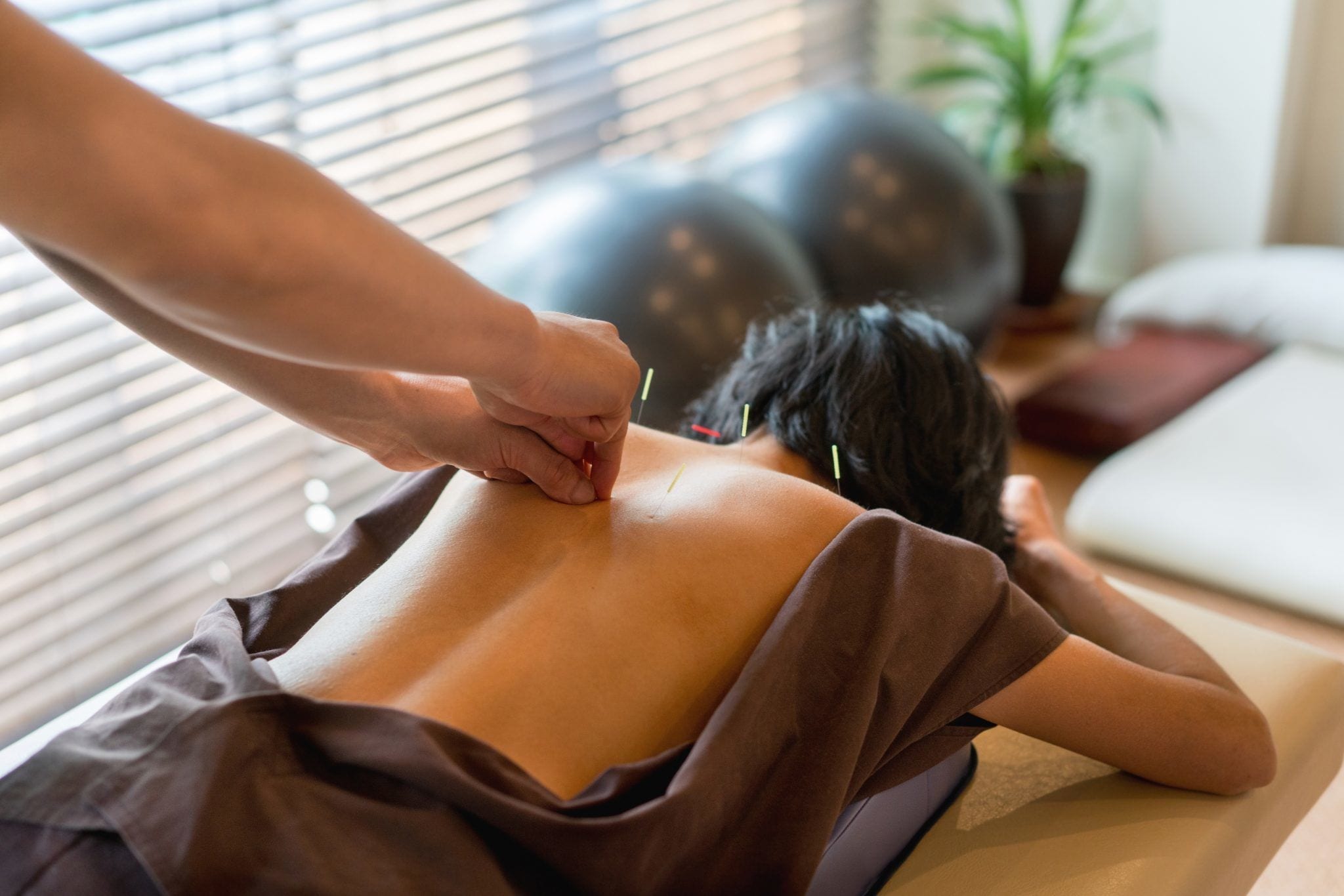 Discover the Benefits of Electro-Acupuncture for Weight Loss