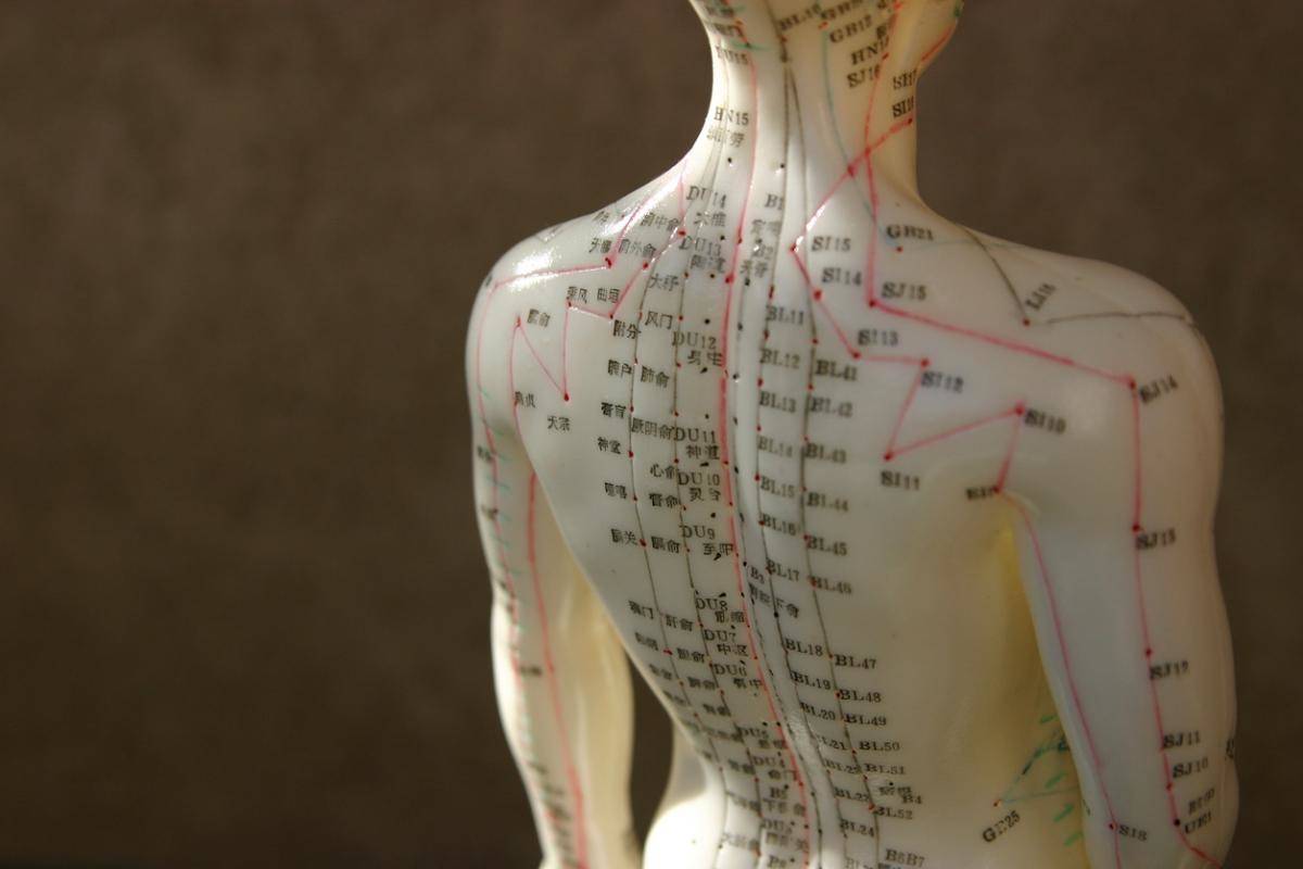 how to use acupuncture to help with PTSD