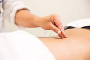 Acupuncture for sports medicine and athletes.