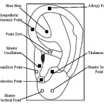 A diagram of ear acupuncture points