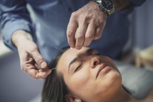 Woman getting acupuncture treatment
