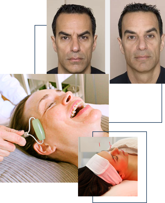 cosmetic acupuncture training