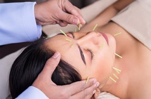 Woman getting acupuncture in her face.