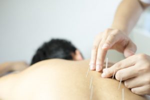 acupuncture schools in new york