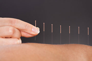 acupuncture school near me