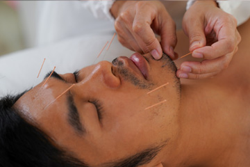 training in acupuncture