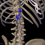 Fig 5: Image anatomy generated by ZygoteBody Professional™, modified and processed by Brian Lau.