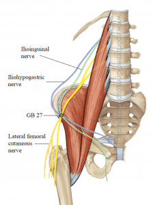 Pattern of left flank pain from the thoracolumbar junction syndrome.