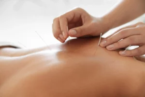 acupuncture schools near me