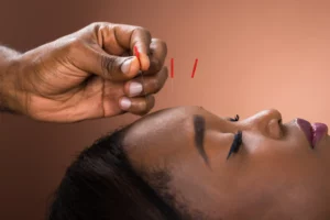 acupuncture colleges near me